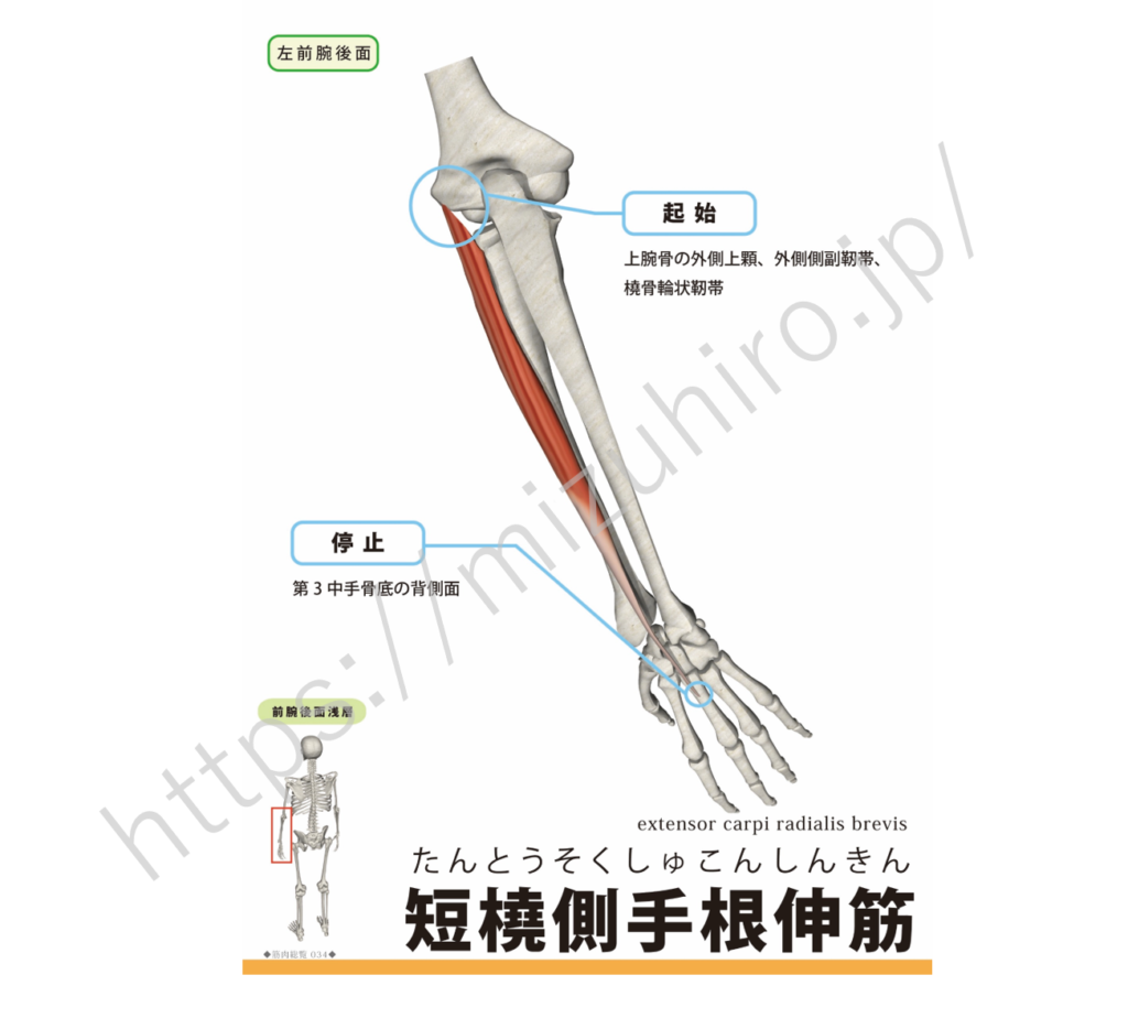 短橈側手根伸筋extensor carpi radialis brevis muscle (イクステンサー・カーパイ・レイディアリス・ブレ ...